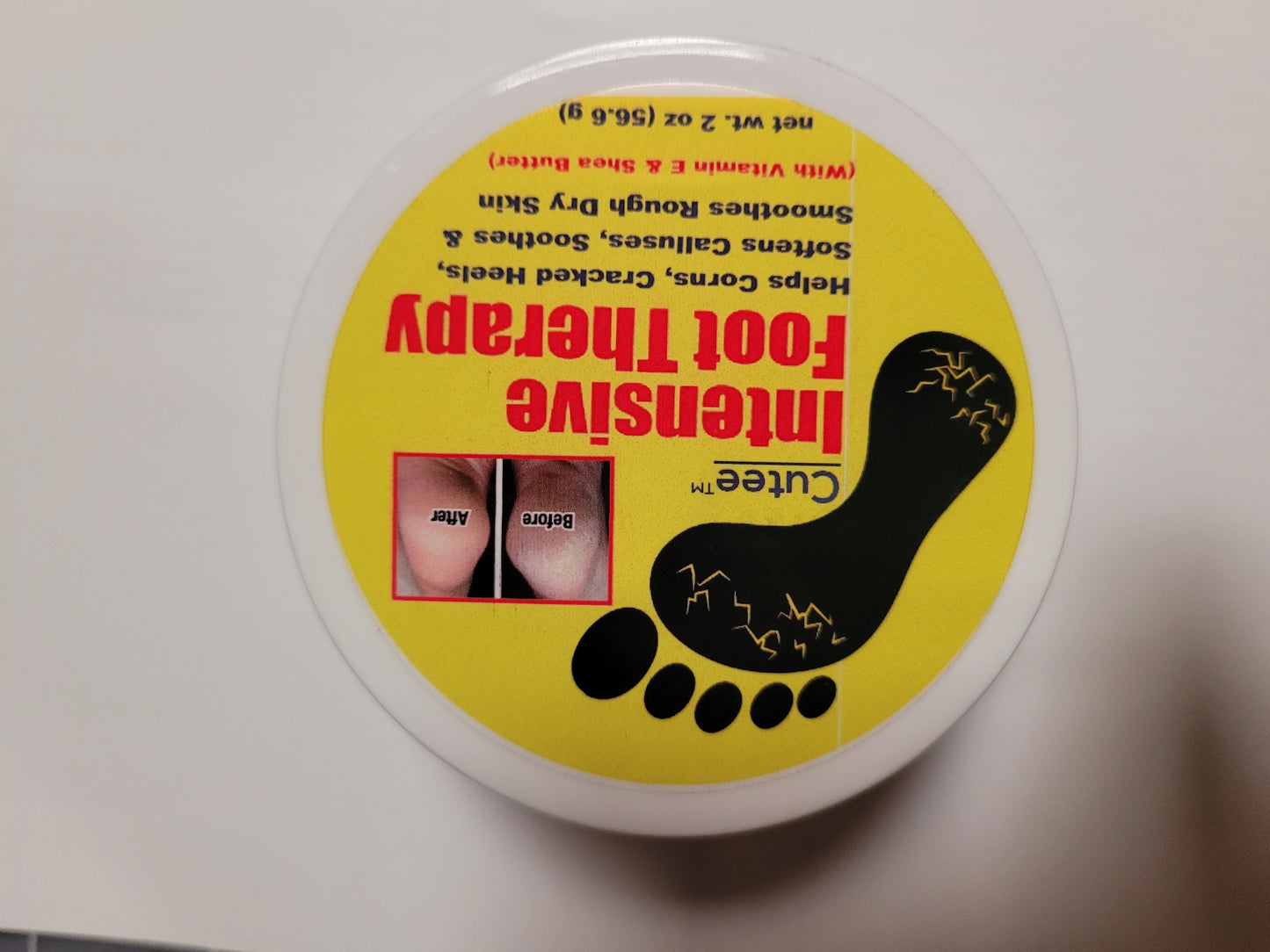 Intensive Foot Therapy